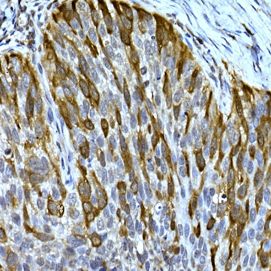 RRM2 Rabbit polyclonal antibody