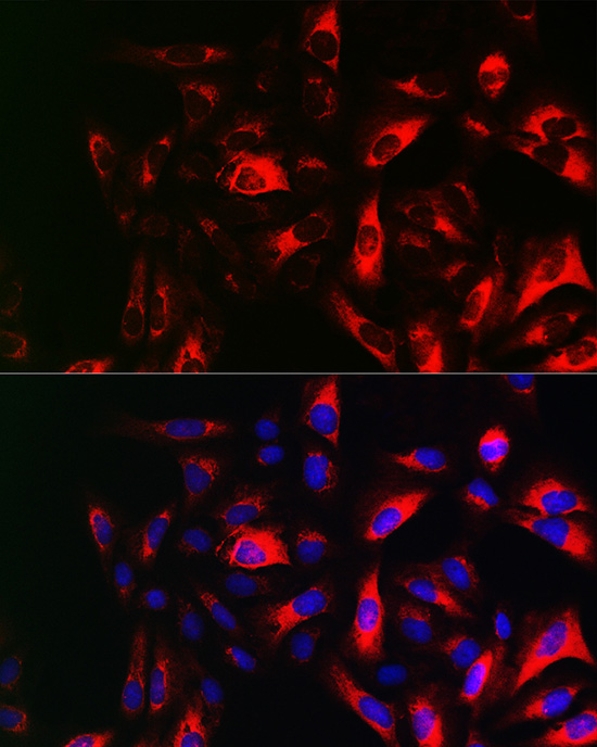 RRM2 Rabbit polyclonal antibody