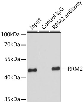 RRM2 Rabbit polyclonal antibody