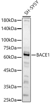 BACE1 Rabbit polyclonal antibody