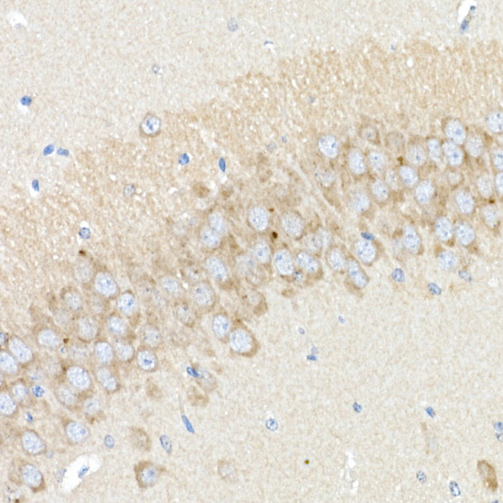 BACE1 Rabbit polyclonal antibody
