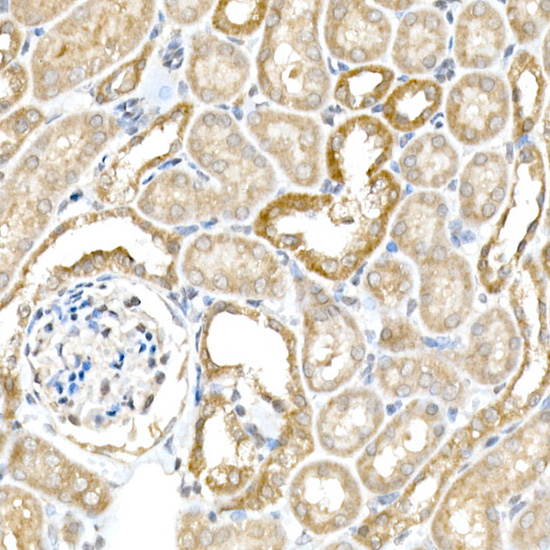 BACE1 Rabbit polyclonal antibody