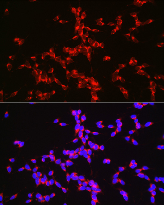 BACE1 Rabbit polyclonal antibody