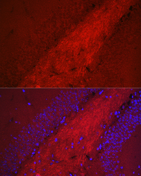 BACE1 Rabbit polyclonal antibody