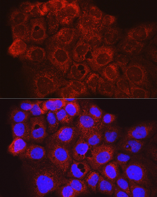 CD63 Rabbit polyclonal antibody
