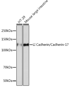 LI Cadherin/Cadherin-17 Rabbit monoclonal antibody