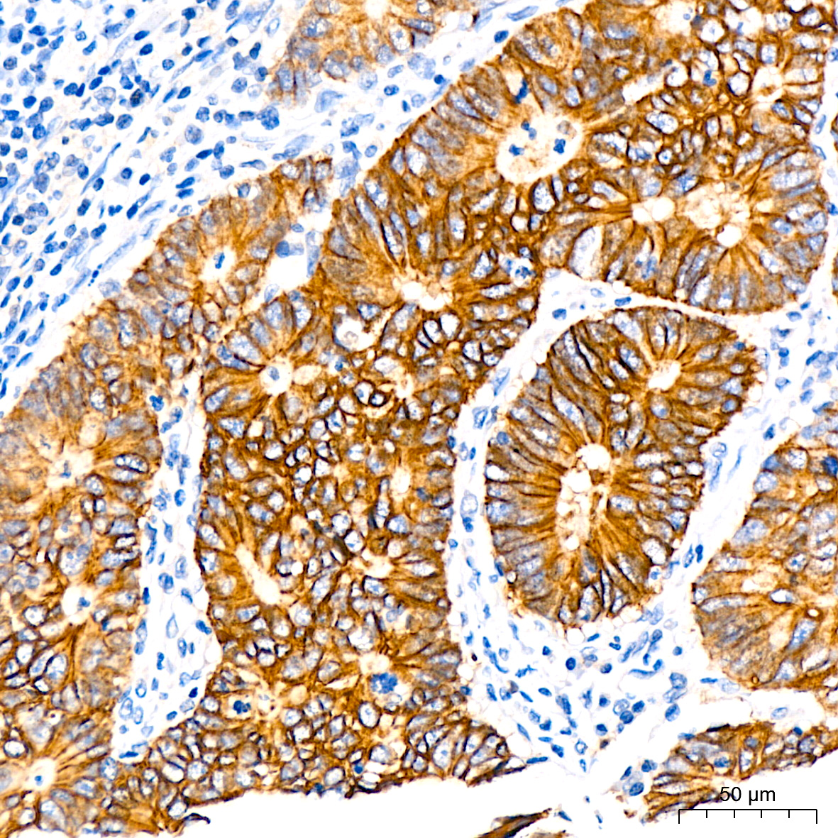 LI Cadherin/Cadherin-17 Rabbit monoclonal antibody