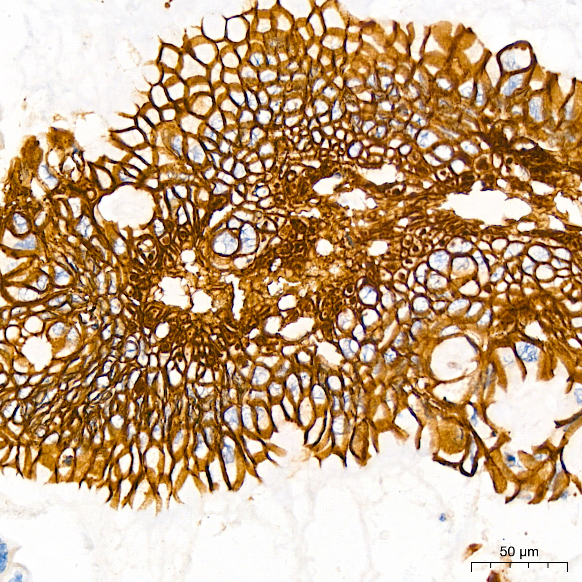 LI Cadherin/Cadherin-17 Rabbit monoclonal antibody