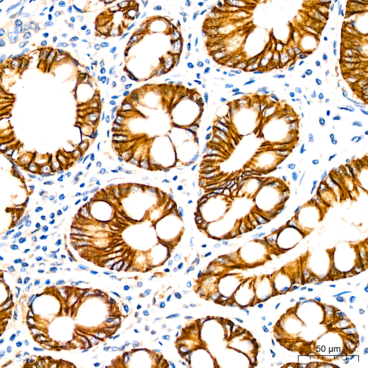 LI Cadherin/Cadherin-17 Rabbit monoclonal antibody