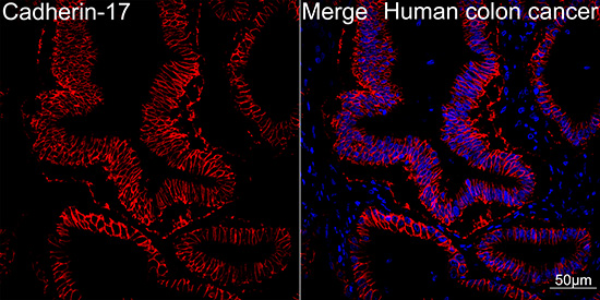 LI Cadherin/Cadherin-17 Rabbit monoclonal antibody