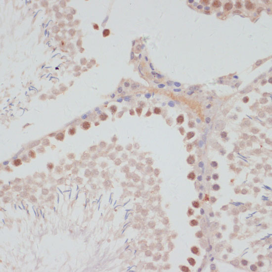 Cyclin G1 Rabbit polyclonal antibody