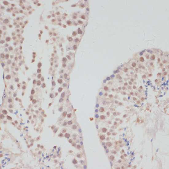 Cyclin G1 Rabbit polyclonal antibody