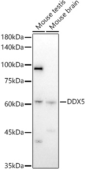DDX5 Rabbit polyclonal antibody