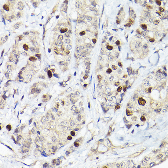 RGAP1 Rabbit polyclonal antibody