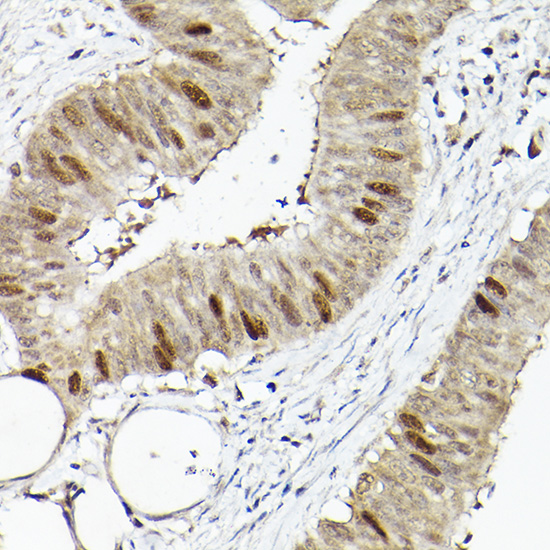 RGAP1 Rabbit polyclonal antibody