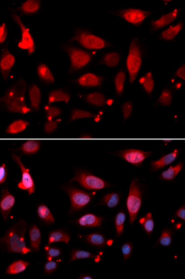 RGAP1 Rabbit polyclonal antibody