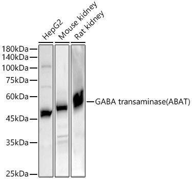 GABA transaminase (ABAT) Rabbit polyclonal antibody