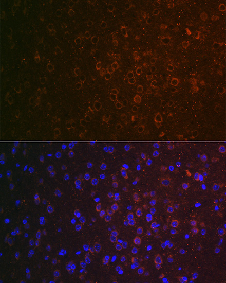 GABA transaminase (ABAT) Rabbit polyclonal antibody