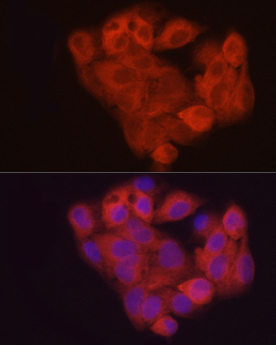 AHCY Rabbit polyclonal antibody