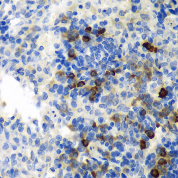 AIMP1 Rabbit polyclonal antibody
