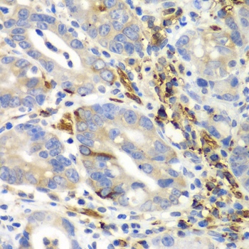 AIMP1 Rabbit polyclonal antibody