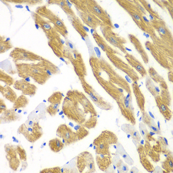 AIMP1 Rabbit polyclonal antibody