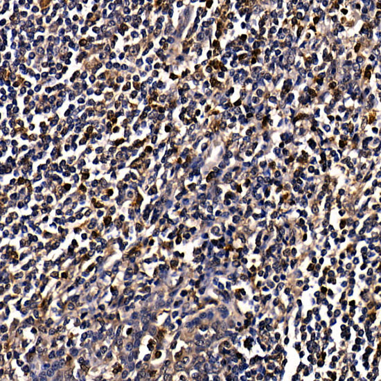 CAMK4 Rabbit polyclonal antibody