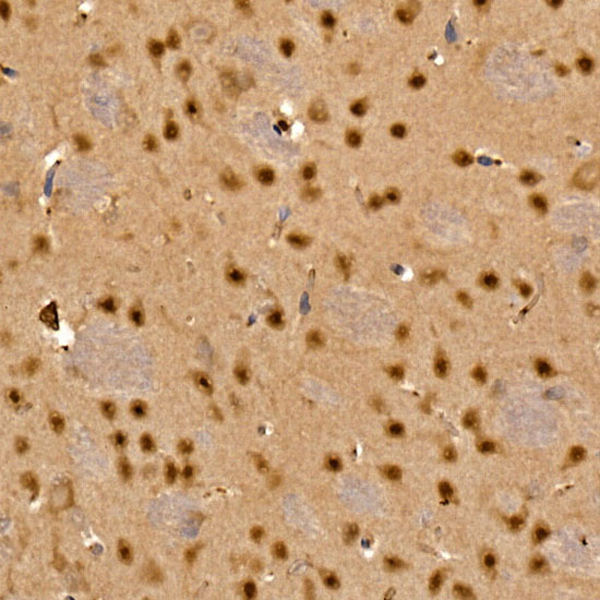 CAMK4 Rabbit polyclonal antibody