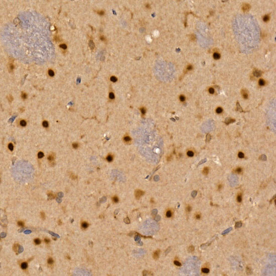 CAMK4 Rabbit polyclonal antibody
