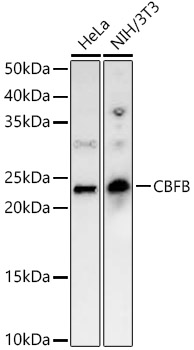 CBFB Rabbit polyclonal antibody