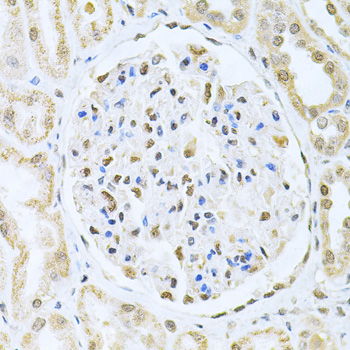 CBFB Rabbit polyclonal antibody