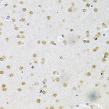 CBFB Rabbit polyclonal antibody