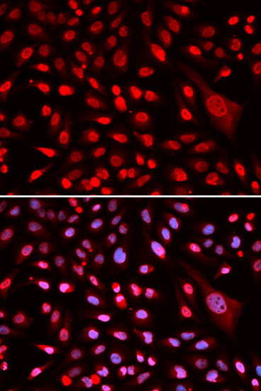 CBFB Rabbit polyclonal antibody