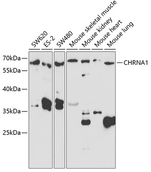 CHRNA1 Rabbit polyclonal antibody