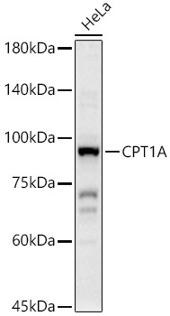 CPT1A Rabbit polyclonal antibody