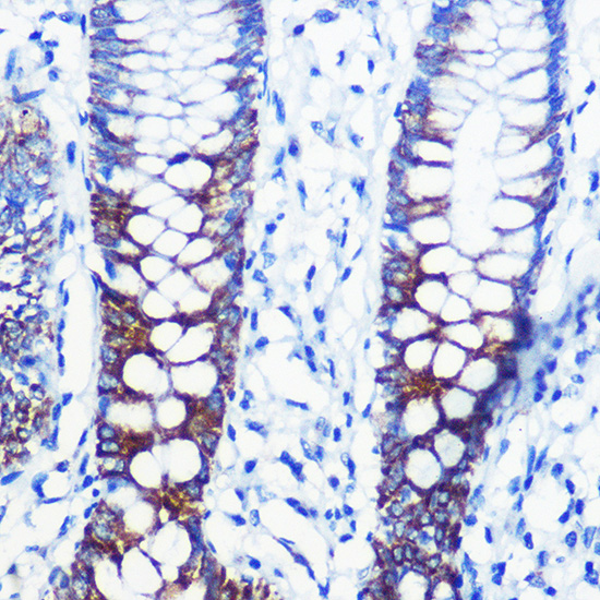 CPT1A Rabbit polyclonal antibody