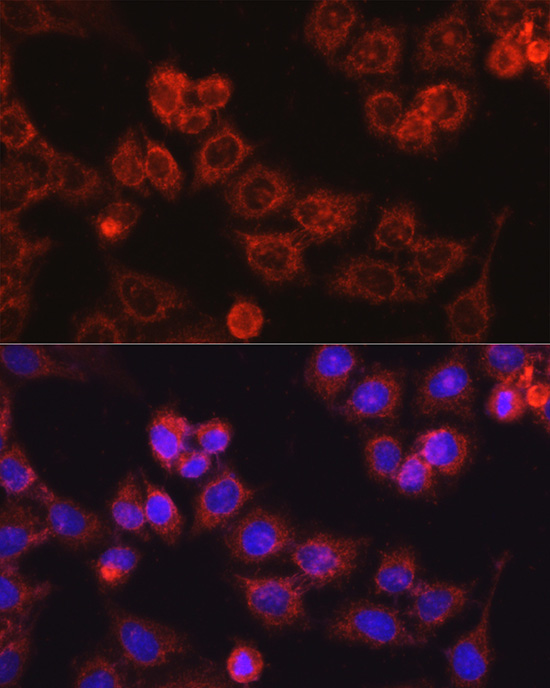 CPT1A Rabbit polyclonal antibody