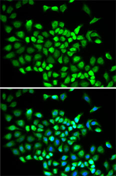 Cullin 2 Rabbit polyclonal antibody