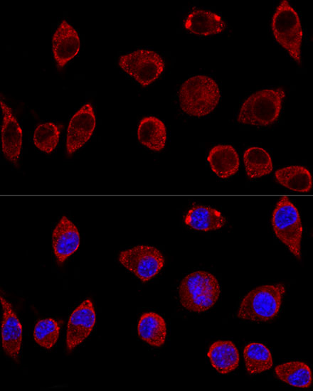 DAO Rabbit polyclonal antibody