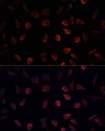 FABP1 Rabbit polyclonal antibody