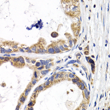FABP3 Rabbit polyclonal antibody
