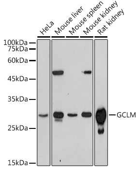 GCLM Rabbit polyclonal antibody