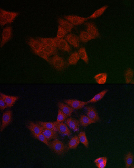 GCLM Rabbit polyclonal antibody