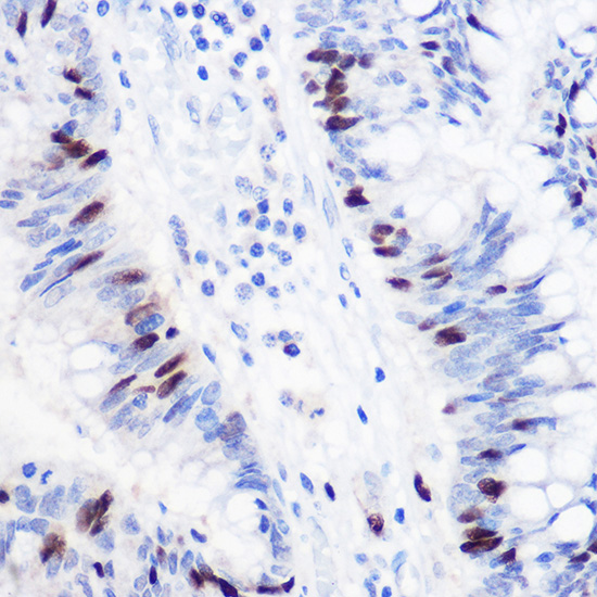 GMNN Rabbit polyclonal antibody