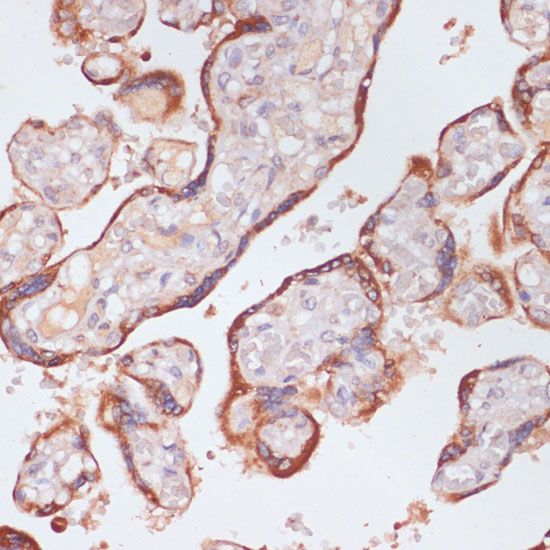 KLKB1 Rabbit polyclonal antibody