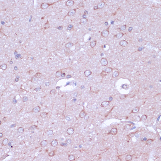 PKA C-beta (PRKACB) Rabbit polyclonal antibody