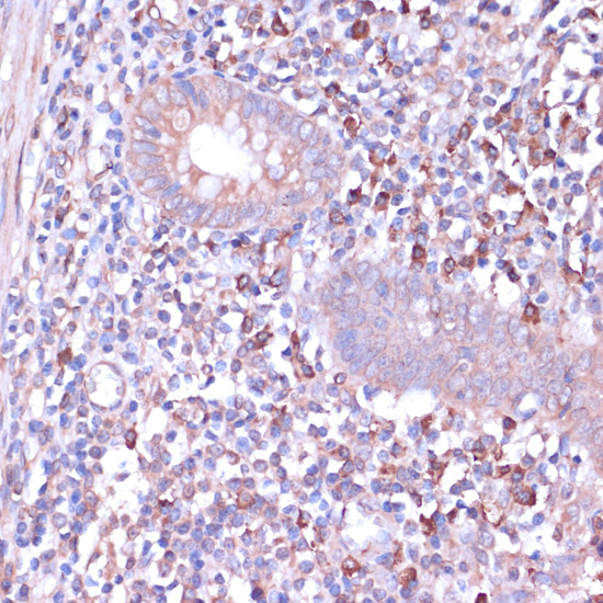 PKA C-beta (PRKACB) Rabbit polyclonal antibody