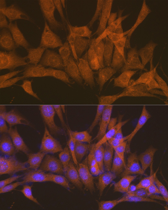 PKA C-beta (PRKACB) Rabbit polyclonal antibody