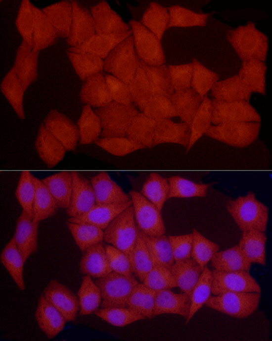 PKA C-beta (PRKACB) Rabbit polyclonal antibody