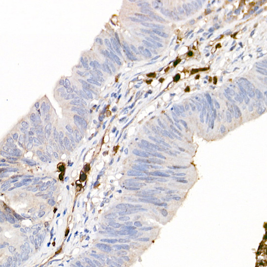 S100A12 Rabbit polyclonal antibody